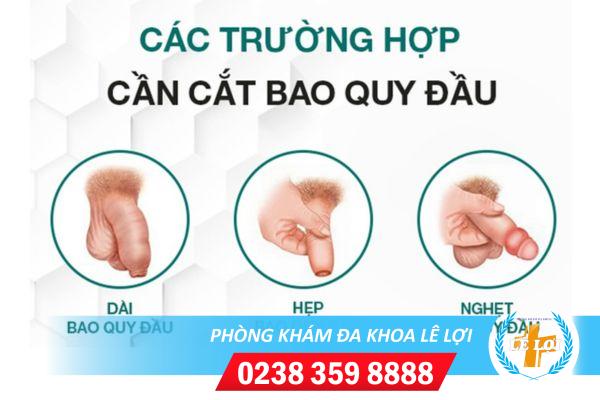 can-cat-bao-quy-dau-gap-o-nhung-truong-hop-nao-1