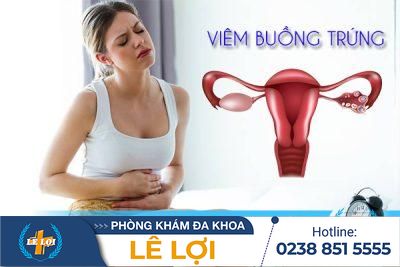 Bệnh viêm buồng trứng ở nữ giới