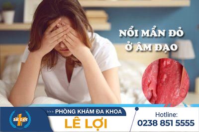 Nổi mẩn đỏ ở âm đạo