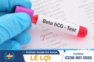 Xét nghiệm beta HCG là gì?
