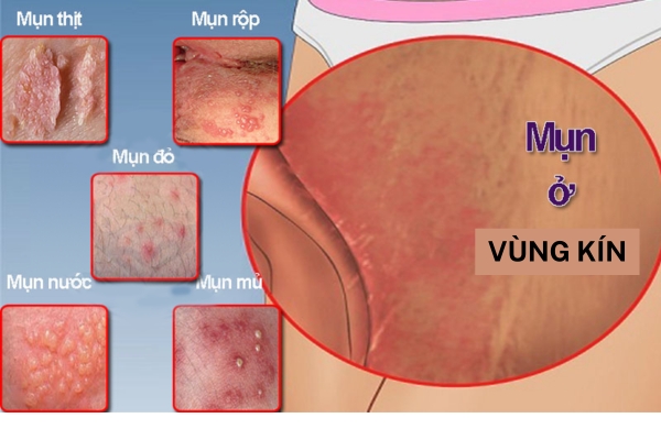 mun-o-vung-kin