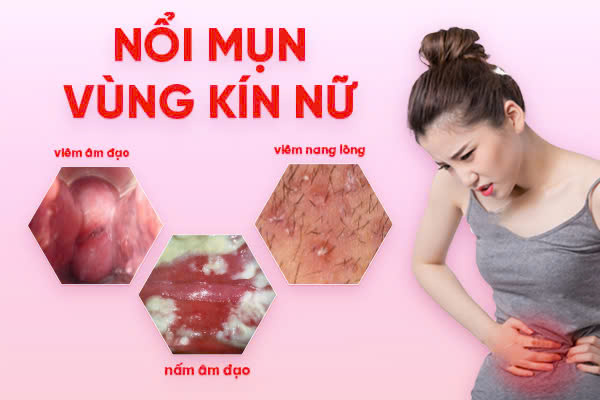 mun-vung-kin-nu-do-dau